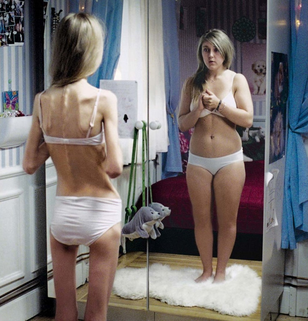 link between eating disorders and sexual abuse
